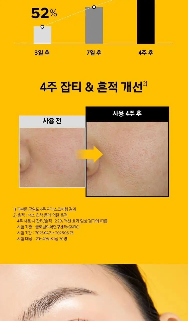 [7월올영픽] 프리메라 세럼 3종 기획 (비타티놀/3C히알루론산/PDRN) 택1 상세페이지 15